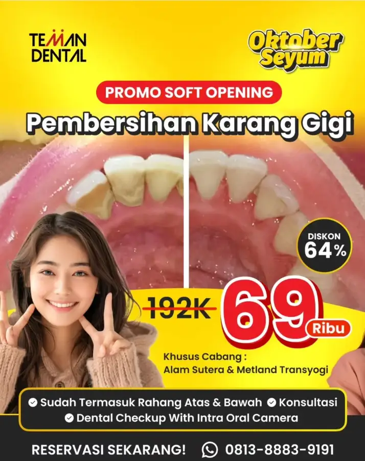 Promo Karang Gigi Dental